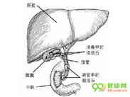 胆囊胆固醇沉着症